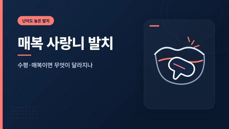 매복 사랑니 발치 썸네일